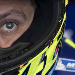 Rossi determined to race despite 'severe' pain