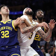 Update on the eye injury Anthony Davis suffered against the Warriors