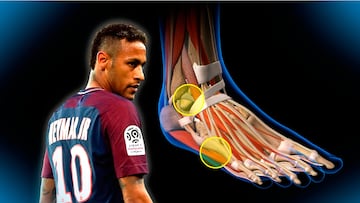 El gráfico que explica cómo es la lesión de Neymar