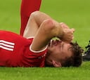 Las lesiones desarman al Bayern