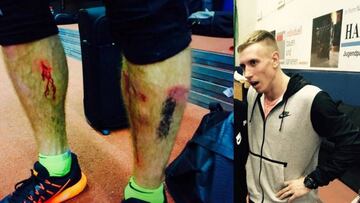 Lisek parte su pértiga, cae y se hace unas aparatosas heridas