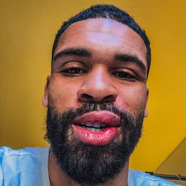 El propio Loftus‑Cheek publicó un mensaje agradeciendo al personal médico, a los aficionados por su apoyo y a sus compañeros de equipo, asegurando que lo peor ya había pasado y que volverá más fuerte.
