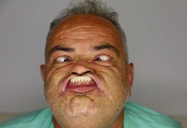 En 2010 una señora que participaba en el evento se desmayó tras aguantar 4 minutos haciendo el mismo gesto.