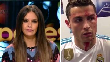 Im&aacute;genes de Cristina Pedroche en Zapeando y de Cristiano Ronaldo en el vestuario mientras le curan de la brecha que se hizo en el partido de Liga frente al Deportivo de la Coru&ntilde;a