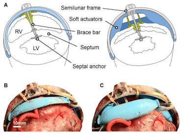 Este robot podría solucionar la insuficiencia cardíaca en el futuro