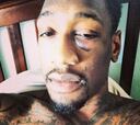 Larry Sanders, seis semanas de baja tras ser operado del ojo
