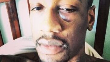 Imagen de Larry Sanders colgada en Instagram.