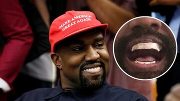 Kanye West es nuevamente el centro de la polémica tras haber decidido reemplazar sus dientes con dentaduras postizas de titanio.