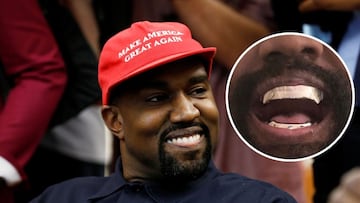 Kanye West es nuevamente el centro de la polémica tras haber decidido reemplazar sus dientes con dentaduras postizas de titanio.