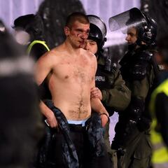 Belgrade derby descends into scenes of bloody violence