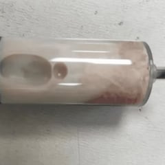 “La sangre es blanca”: sorpresa por la analítica de un paciente que cenó lo mismo durante una semana