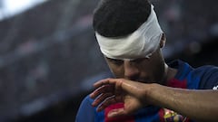 Rafinha suffers broken nose