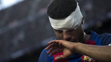 Rafinha suffers broken nose