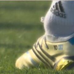 Impactante imagen del tobillo de Messi a 24 horas del debut