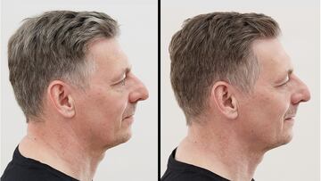 El fenómeno Alpecin Grey Attack: El champú reductor de canas que se agota en las tiendas y lidera las ventas en Amazon España