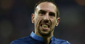 Franck Ribéry, abandonado por sus padres al nacer, pasó los primeros meses de su vida en un convento. A los dos años, el francés estuvo involucrado en un accidente de tránsito que ocasionó sus marcadas cicatrices. Ribéry asegura que son las marcas en su rostro lo que le hacen recordar de dónde viene y lo fuerte que es.