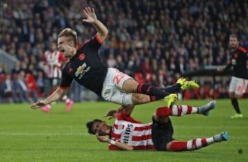 Las imágenes de la fractura de tibia de Luke Shaw