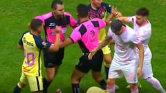 El terrible pisotón que le costó la roja a Valdés ante América