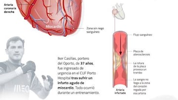 Gráfico: el tratamiento médico al que ha sido sometido Casillas