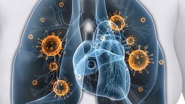 Disnea por coronavirus: qué es, cómo tratarla y qué secuelas puede dejar en el organismo