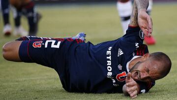 La U tiene un equipo completo de lesionados en tres meses