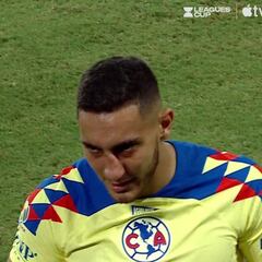 Le rompen la nariz a Sebastián Cáceres en el América vs Nashville