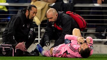 Durante el partido de la Concacaf Champions Cup, Lukas Macnaughton le hizo una dura entrada a Messi que de milagro no lesionó a Messi.