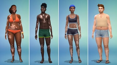 The Sims 4 adds vitiligo skin via a free update