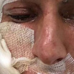 Jürgen Damm agradece apoyo tras accidente con pirotecnia