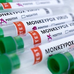 California, Nueva York e Illinois en estado de emergencia por viruela de mono