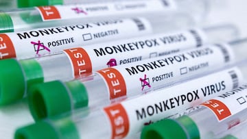 Los casos de monkeypox continúan en aumento en Estados Unidos. California, Nueva York e Illinois declaran estado de emergencia por la viruela de mono.