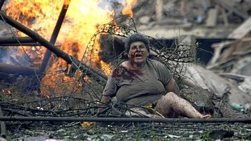 Una mujer herida en el bombardeo ruso contra Gori en 2008.