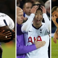 Tosun, sobre la lesión de André Gomes: "Sus ojos se abrieron muchísimo y él estaba gritando"