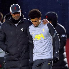 Klopp: "Pensaba que había visto todo tipo de lesiones, pero no…"