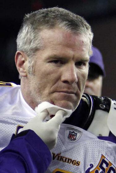 Quiniela irracional (semana 11)