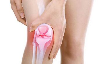 ¿Tienes dolor de rodilla y 30 años de edad?, tu cartílago se esta deteriorando por esta razón