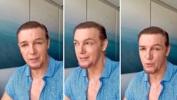 Aarón Beas, actor de telenovelas rompe el silencio y pide disculpas públicas tras actos discriminatorios de Lady Racista, su expareja sentimental.