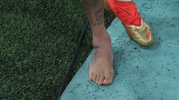 Picture of the swollen ankle of Brazil's forward #10 Neymar taken as he leaves the field at the end of the Qatar 2022 World Cup Group G football match between Brazil and Serbia at the Lusail Stadium in Lusail, north of Doha on November 24, 2022. (Photo by Giuseppe CACACE / AFP)