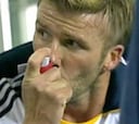 Beckham sufre un tipo de asma leve que le obliga a utilizar inhalador