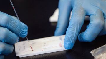 Test serológico del coronavirus.