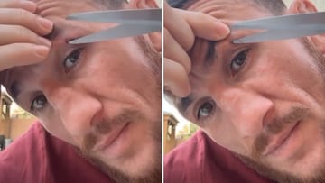 Watch: UFC fighter shocks fans by cutting stitches from eye injury