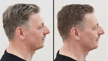 El fenómeno Alpecin Grey Attack: un champú reductor de canas Nº1 en Amazon