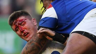 Susto en el 6 Naciones: Curry se fue con la cara ensangrentada