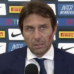 "Estaré contento con Vidal incluso cuando juegue de portero"