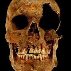 Los arqueólogos examinan los dientes del esqueleto de un soldado y se topan con un oscuro secreto