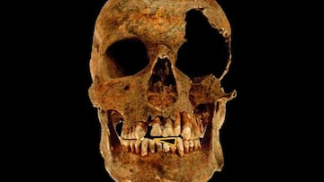 Los arqueólogos examinan los dientes del esqueleto de un soldado y se topan con un oscuro secreto