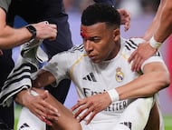 LaLiga denies that the injury was concealed and points out that Reis’s elbow was replayed up to eight times.