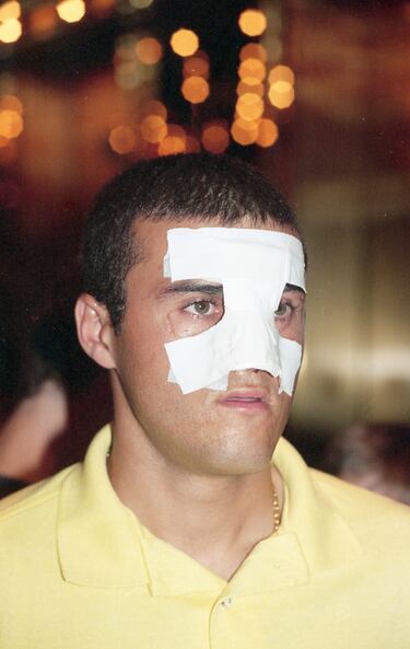 El propio Tassotti durante una entrevista al diario El País comentó: "Disputábamos un balón. Alargué el brazo porque me sentí agarrado. Yo me equivoqué y me arrepentí. Nunca lo he negado. Nunca me he escondido de mi responsabilidad. Lo siento, me disculpo otra vez. Comprendo también que él al principio no quisiera aceptar mis disculpas". Finalmente, tras varios años el jugador italiano consiguió el perdón del español.