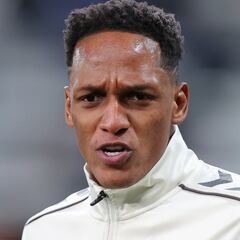 Yerry Mina, entre 8 y 10 semanas de baja en Everton por lesión