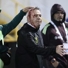 Mexico coach Javier Aguirre left bloodied in shocking scenes after Honduras defeat
